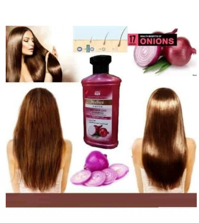 Wellice Professional Onion Shampoo Anti Hair Loss Shampoo - Organic Shampoo - 400g